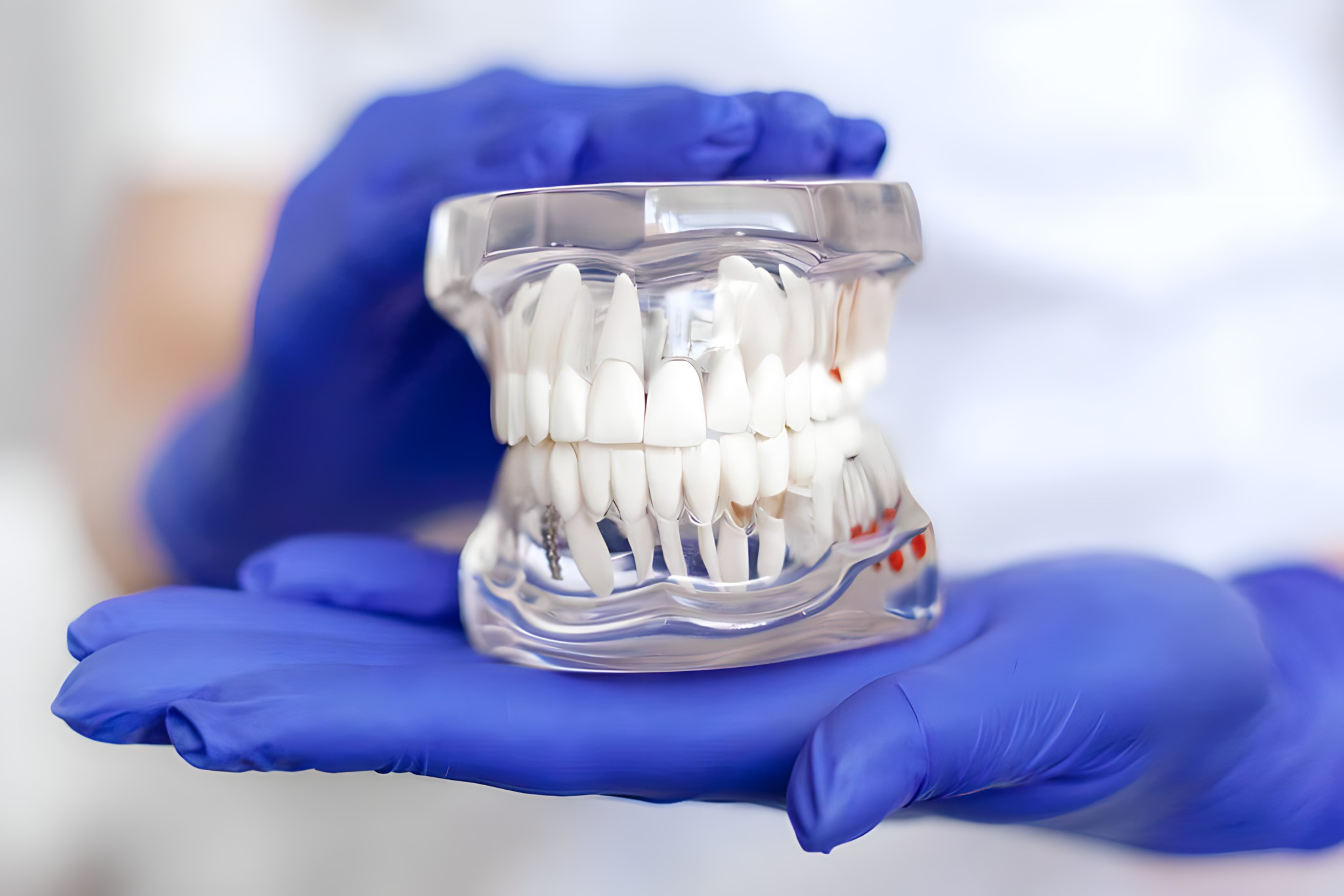 Teeth in a Day Options
