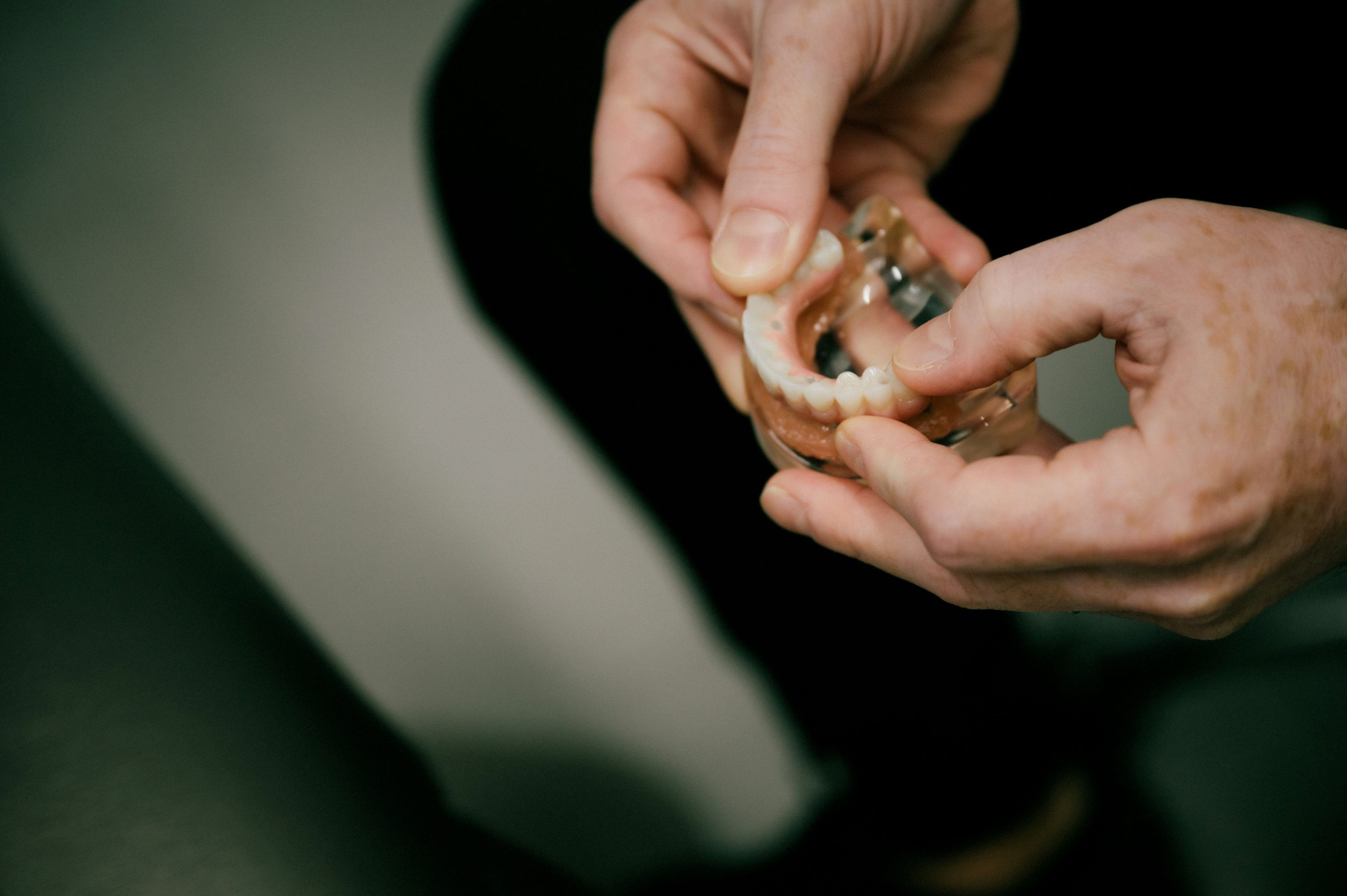 The Enduring Benefits of Dental Implants